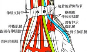 示指伸肌和指伸肌腱腱鞘炎